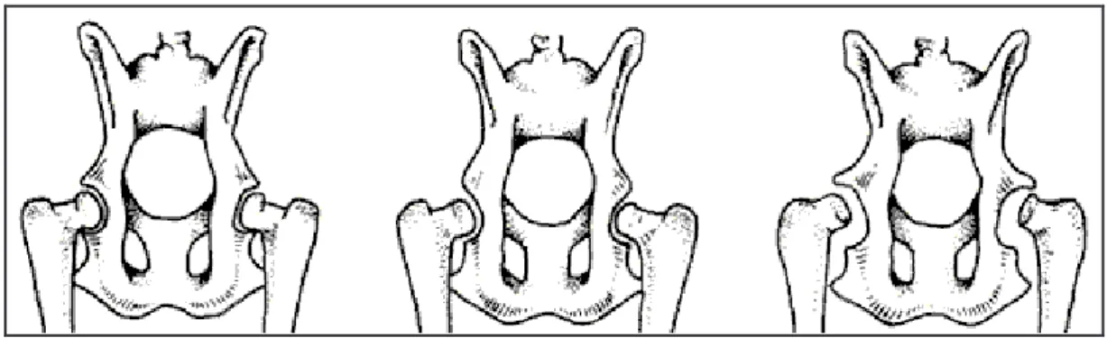 Figura  9:  le  immagini  raffigurano  tre  pelvi  in  proiezione  ventro  dorsale  con  le  articolazioni  normali, 