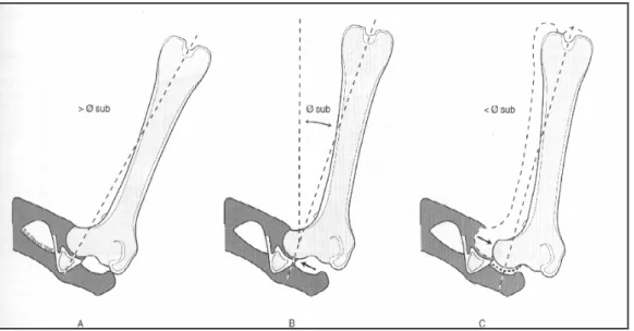 Figura  18  La  lussazione  dell’anca  ottenuta  mediante  l’adduzione  inizia  (superiore  a  sub )  con  la  testa 