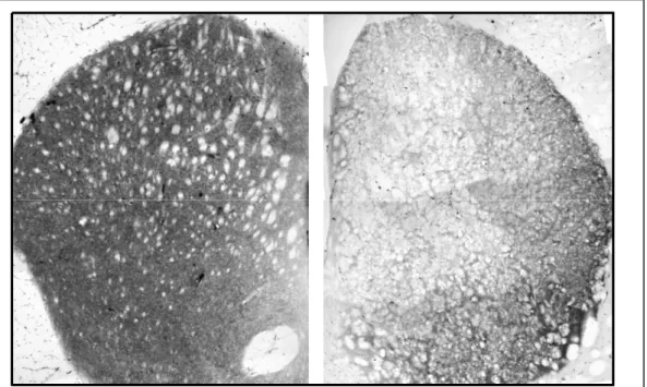 Figura  4.6  Terminali  dopaminergici.  Immunoistochimica  DAT  di  sezioni  di  nucleo  Striato  dorsale  