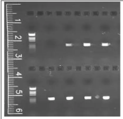 Figura 3.1. Gel di controllo per PCR 