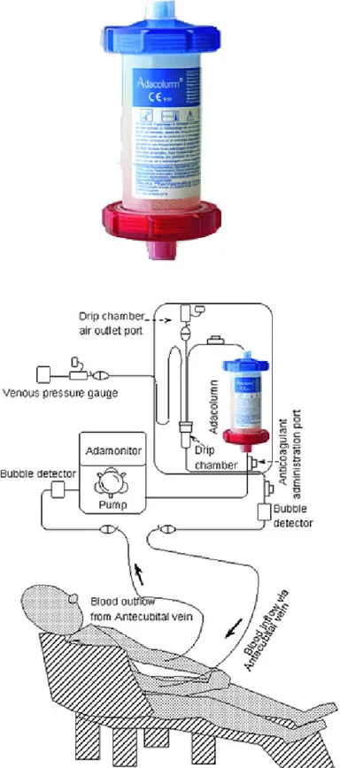 Figura 2: il dispositivo Adacolumn e funzionamento del circuito. 
