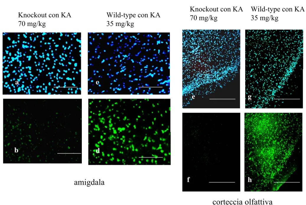 Fig. 14 L’assenza del recettore α1B protegge dal danno indotto da PIL e KA in svariate aree limbiche