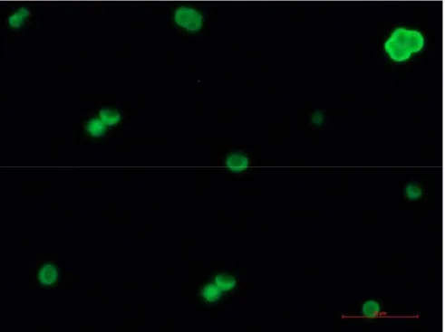 Fig. 6.7 Immagine al microscopio a fluorescenza di CrFK su substrato di CNT   e SiO 2 dopo 24 ore (40X) 