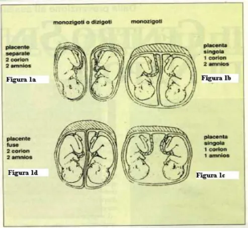 Figura 1.3 Esempi della disposizione della placenta e delle membrane nella 