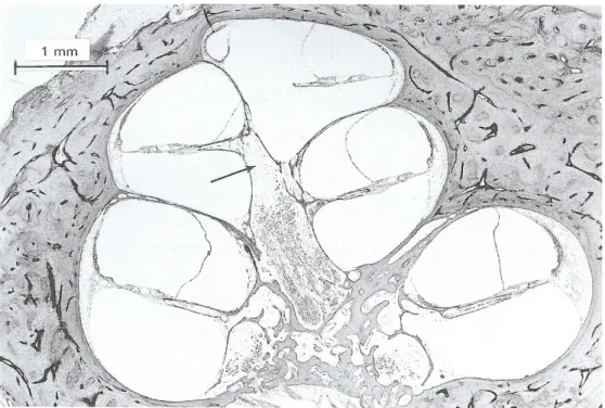 Figura 4: Perdita neuronale nella zona apicale della coclea  