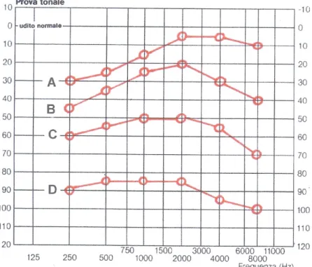 Figura 6: curve audiometriche 