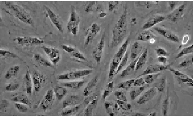 Fig. 2.5b Fotomicrografia delle cellule tumorali umane MIA PaCa-2. 