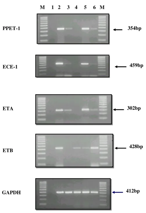 Fig. 20 Visualizzazione delle corse elettroforetiche degli amplificati dei componenti  del sistema endotelina e di GAPDH 