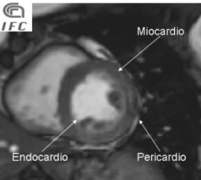 Fig 2.1.3 Struttura del ventricolo sinistro studiata attraverso un immagine SA. 