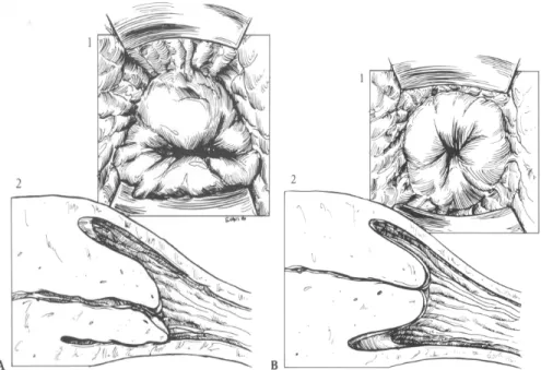 Figura  1.4:  Porzione  vaginale  della  cervice.  A,  durante  l’estro  e  B,  durante  il  diestro