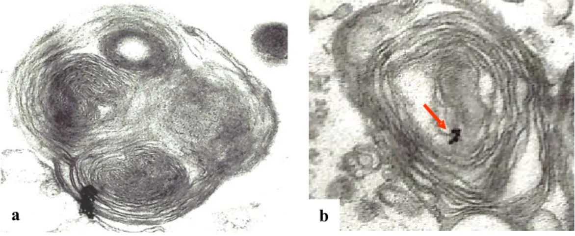 Figura 8: Immagini di immuno microscopia elettronica a trasmissione per la 