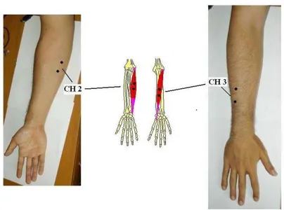 Figura 15.Repere anatomici relativi al movimento di adduzione del polso.CH2 posizionato al centro del CUBITALE ANTERIORE e 