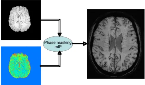 Fig. 4-11. Procedures for merging magnitude and phase images to obtain high- high-resolution BOLD venography