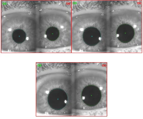 Fig.  11 . Immagine fotopica, basso mesopica,  scotopica. 