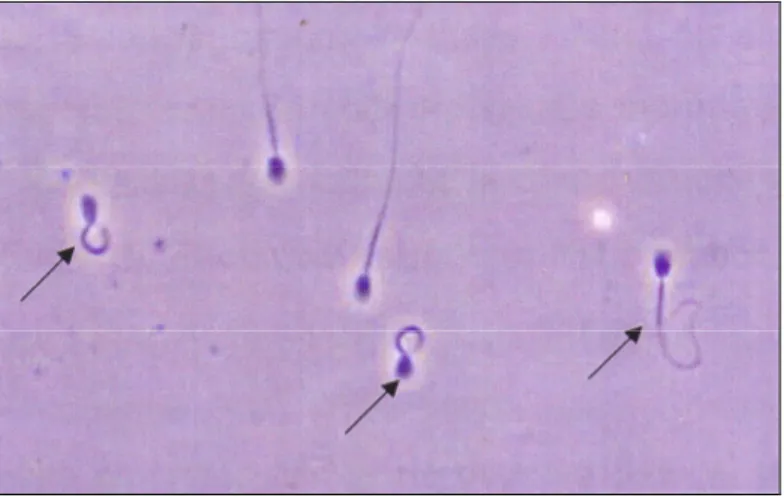 Figura 1 – HOS-test: spermatozoi di cane con membrana plasmatici integra (freccia) che  rispondono positivamente al test con arriciolamento della coda