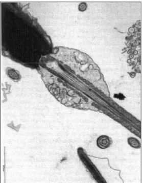 Figura  3  –  Microscopio  elettronico.  Sezione  sagittale  di  uno  spermatozoo  canino  con  goccia citoplasmatica prossimale (preso da un campione di seme di un soggetto infertile)  (Peña et al, 2007) 