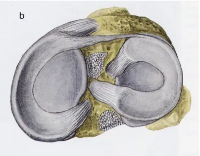 Fig 9: immagine delle cavità glenoidee con i rispettivi menischi