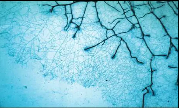 Fig.  6  -  La  rete  micorrizica  extraradicale  formata  dal  fungo    Glomus  mosseae  circonda  l'apparato radicale di Prunus cerasifera (da Giovannetti et al