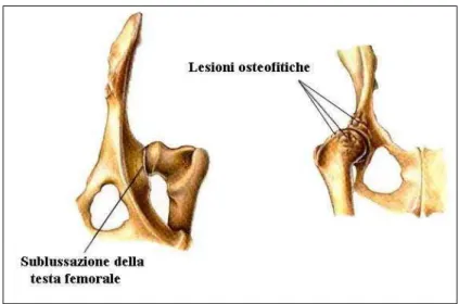 Figura  3  –  Alterazioni  a  carico  delle 