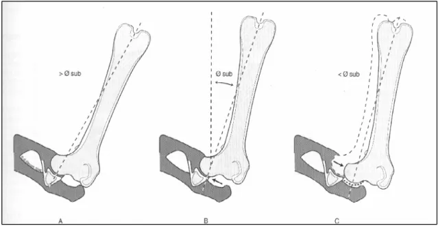 Figura 11 – Sublussazione dell’anca ottenuta mediante sua adduzione 