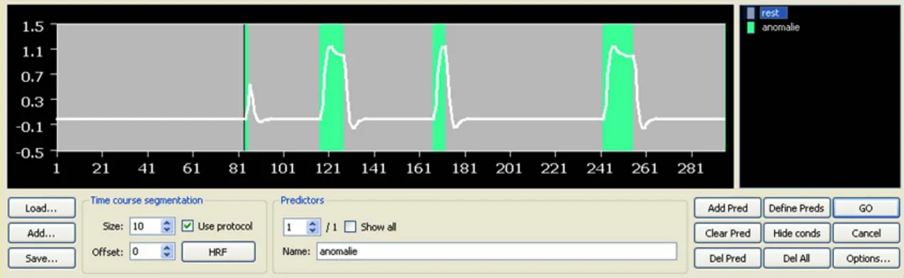 Figura 1.7  Predittore GLM. Sull’asse delle ascisse è rappresentato il tempo (unità di misura espressa in termini  di  volume  di  acquisizione  fMRI  corrispondente)