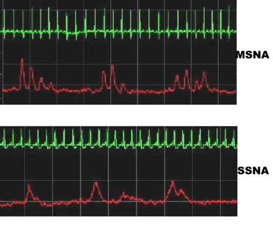 Figura  3.  Esempi  di  registrazione  dell’attività  nervosa  simpatica  muscolare  e  cutanea  ottenute  con  tecnica microneurografica