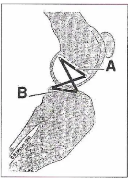 Figura 2 - I quattro punti del modello tradizionale (Slocum &amp; Devine 1983).  