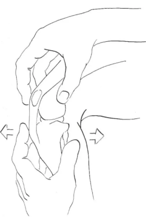 Figura 1 - Esame del cassetto craniale. L’articolazione viene mantenuta in massima estensione e a 30°  di flessione (Hulse DA