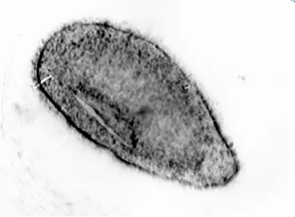 Figura 1.5.4  Immagine fotografica al microscopio ottico di un teronte di O. flava. 