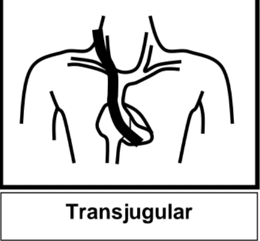 Fig. 2. Inferior Approach 
