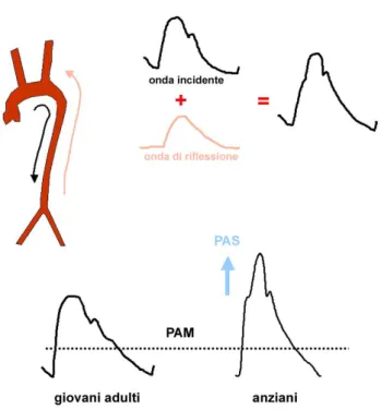 Figura  2:  Differente  morfologia  dell'onda  pressoria  nell'anziano  rispetto  al  giovane  adulto