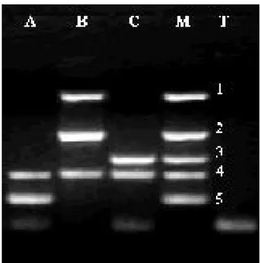 Fig 7: corsa elettroforetica su gel al 2%  dei prodotti di PCR 