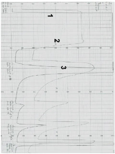 Figure 24R: Chromatogram profile of TMAE Fractogel preliminary results with  Supernatant of Fraction I (1: loading, 2: washing, 3: elution, ) 