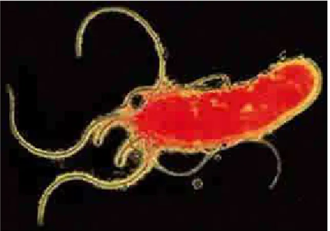 Figura 1: immagine di Helicobacter pylori 