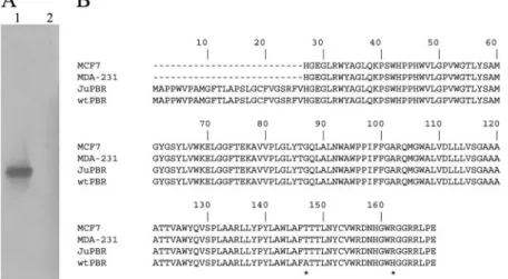 Fig. 1. PBR cDNA isolation in Jurkat cells. A, Southern blot of PBR amplification products