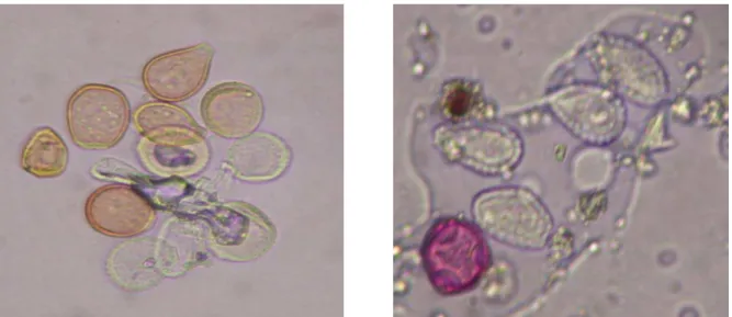 Fig. 2.9 - 2.10 Spore di Uredinales causa di ruggine:  a destra visione da campionamento volumetrico 