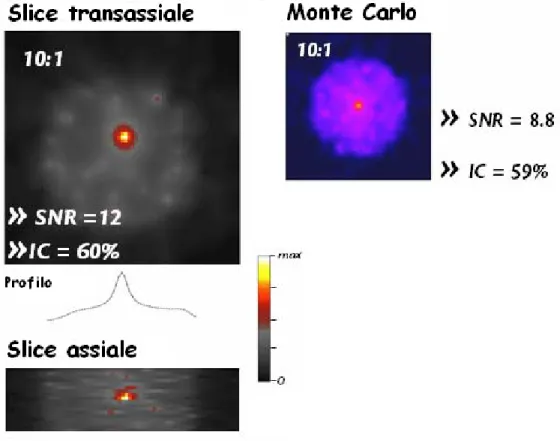 Figura 5.5: A sinistra: immagini tomografiche relative allo scan con T/B = 10:1. A destra: immagine ricostruita dalla simulazione Monte Carlo con analogo T/B.