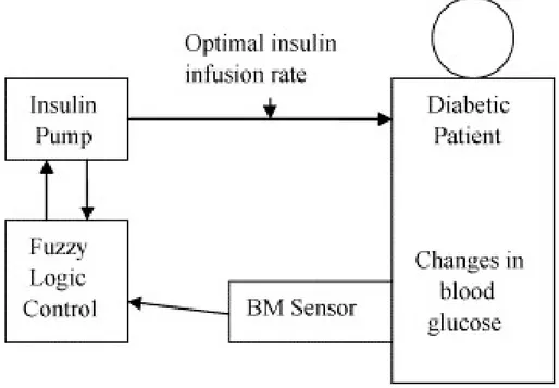 Fig. 1 1 . Demonstrates a closed loop feedback system, which continuously monitors the patient's blood glucose  level and adjusts the infusion of insulin to an optimal rate