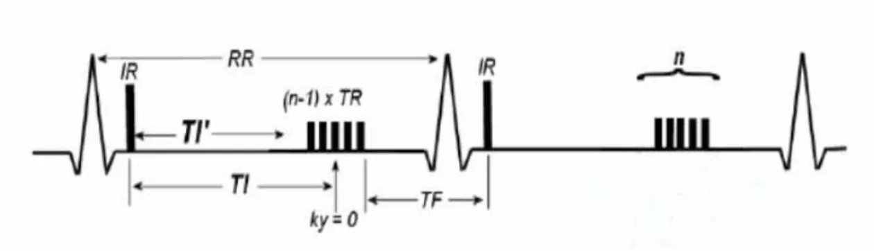 Figura 1.3: sequenza FGRE-IR 