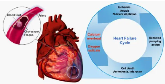Figura 1. Fenomeno dell’infarto del miocardio