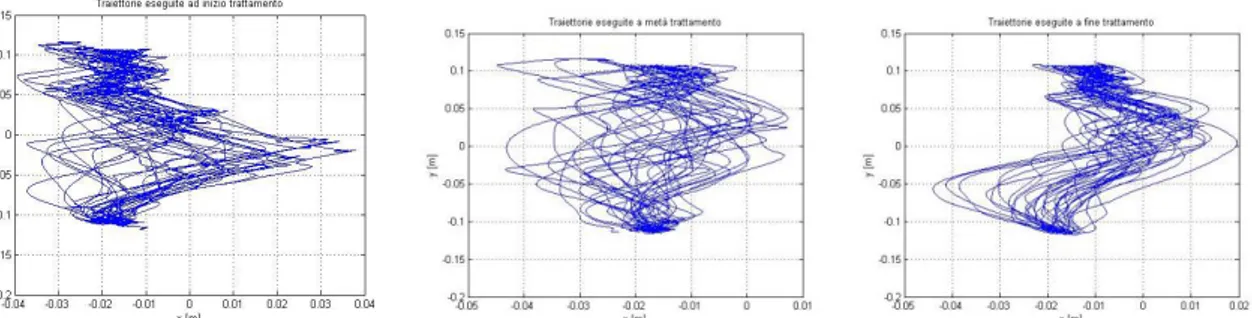 Figura 87. Traiettorie eseguite nelle 35 ripetizioni del movimento di reaching da P01 rispettivamente ad inizio,  metà e fine terapia 