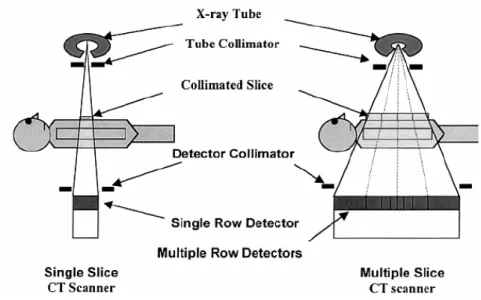 Figura 13: Confronto tra scanner Single Slice e Multiple Slice [1] 