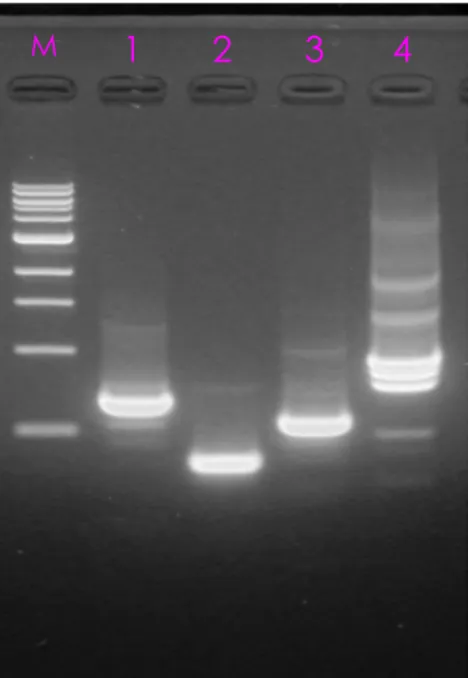 Fig. 4.6: Elettroforesi su gel di agarosio (1,5%) colorato con Bromuro di Etidio.  Corsia 1, DNA amplificato nella reazione di 5’RAGE tagliato con enzima Dra I  Corsia 2, DNA amplificato nella reazione di 5’RAGE tagliato con enzima EcoR V  Corsia 3, DNA am