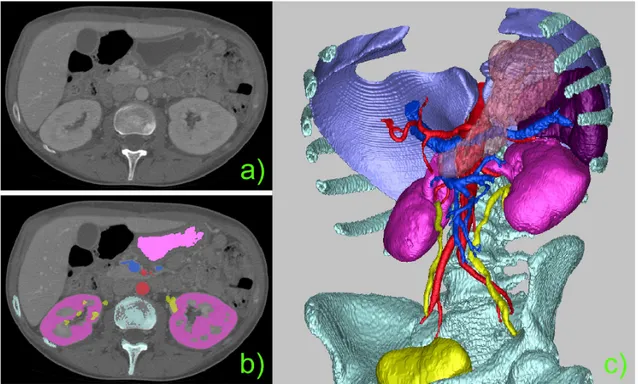 Fig. 7  Modeling of anatomical structures: (a) CT dataset slice, (b) Segmentation and Labeling, (c) 3D surface  models extracted from segmented and labeled images