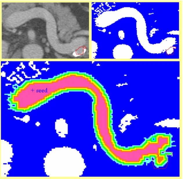 Fig. 11   2D Neighborhood connected region growing example. (upper-left) Original gray-level image