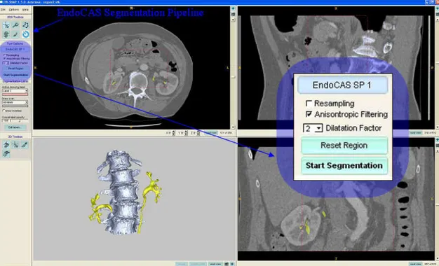 Fig. 13  Initialization of EndoCAS segmentation pipeline in ITK-SNAP. The user selects the working volume, 