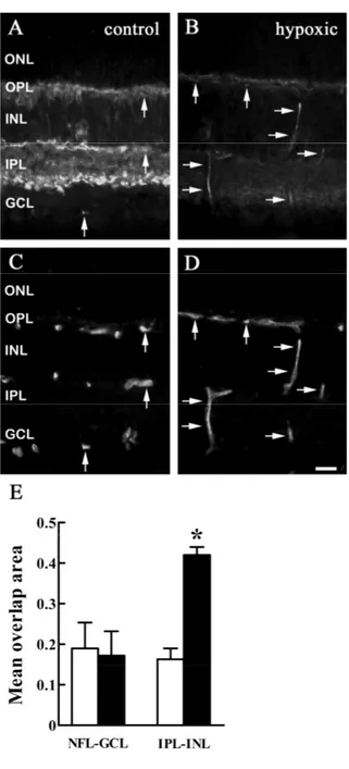 Figura 10.  Le sezioni retiniche mostrano il profilo immunoreattivo di cellule e capillari per sst 2A  (A, B) e 