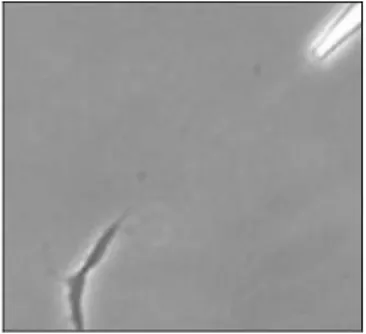 Figure 1. 6 Attractive turning response of an axon toward the gradient of netrin-1.  The gradient was produced by the pulsatile application of a solution, containing  netrin-1, from a micropipette [10]