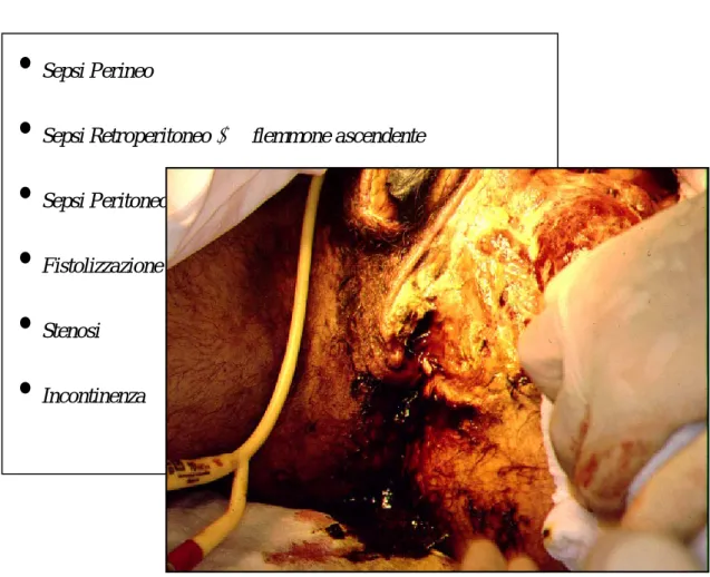 Fig. 12 –  Riassunto delle principali complicanze dei traumi perineali  (Foto:sepsi perineale in paziente con trauma 
