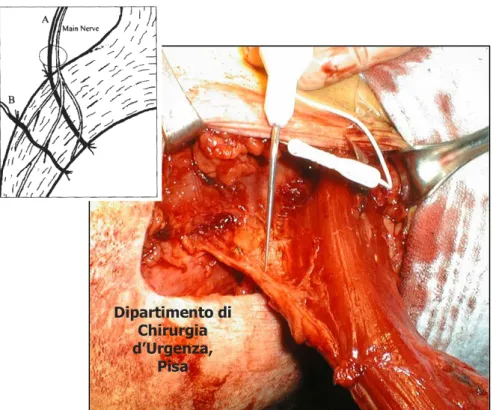 Fig. 18 - Distribuzione del nervo principale 